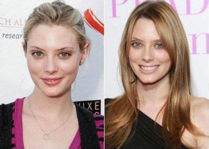 April Bowlby Plastic Surgery Before and After