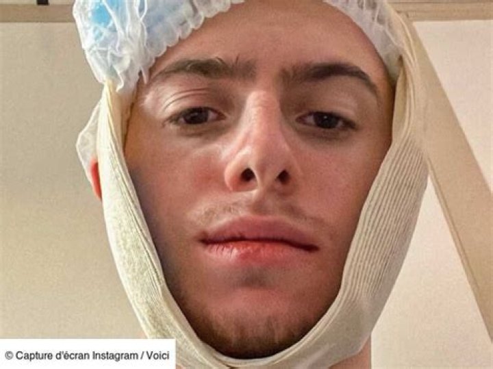 Michou Youtubeur Mort